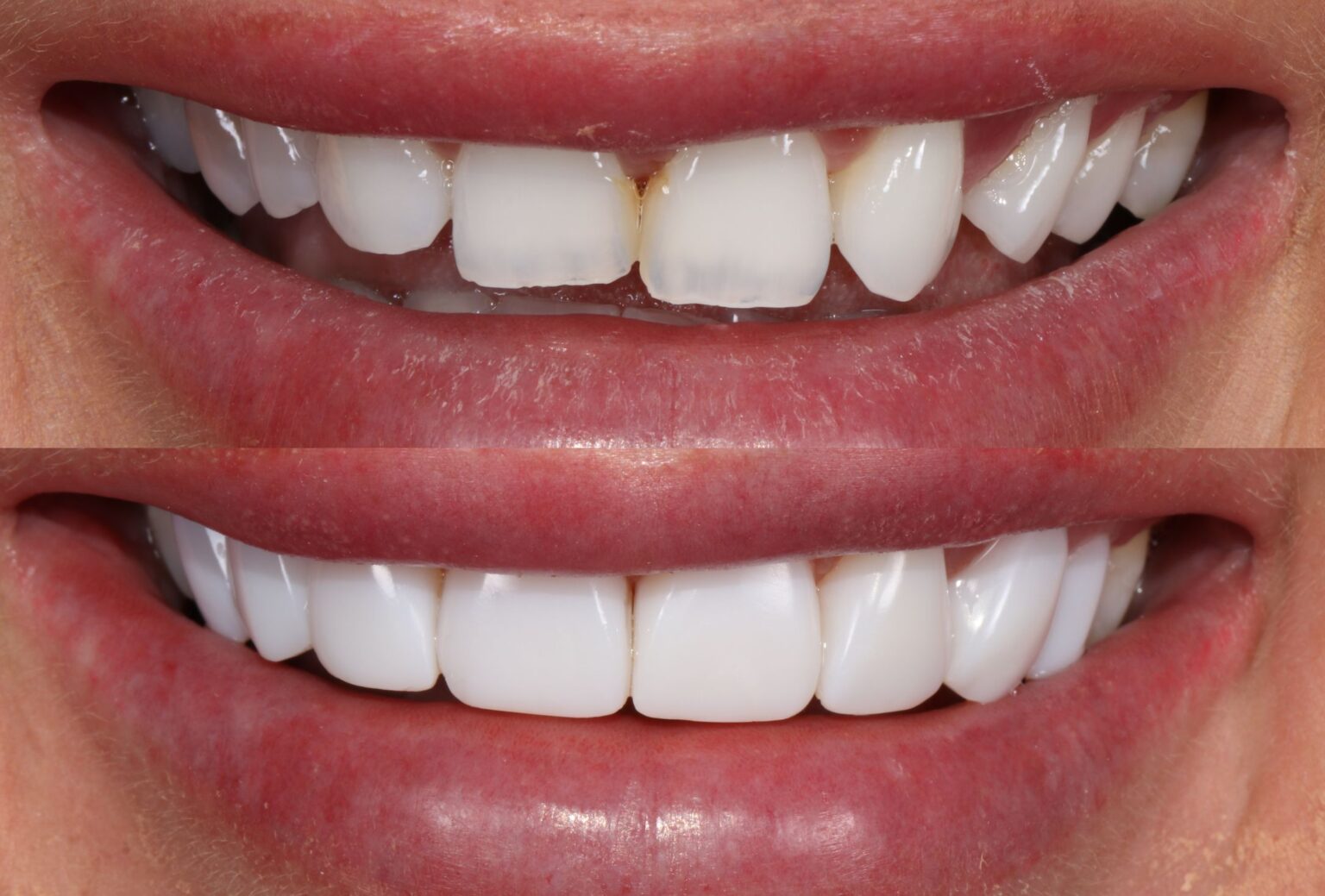 Cosmetic Dentistry The Dental Centre Belfast